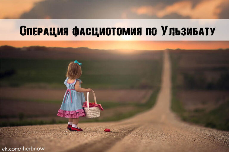 Подробнее о статье Сравнение операции по Ульзибату и SPML при ДЦП